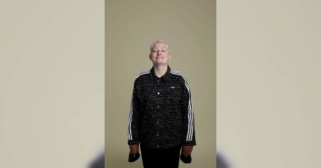 Image Harriet Dyer: Easily Distra...